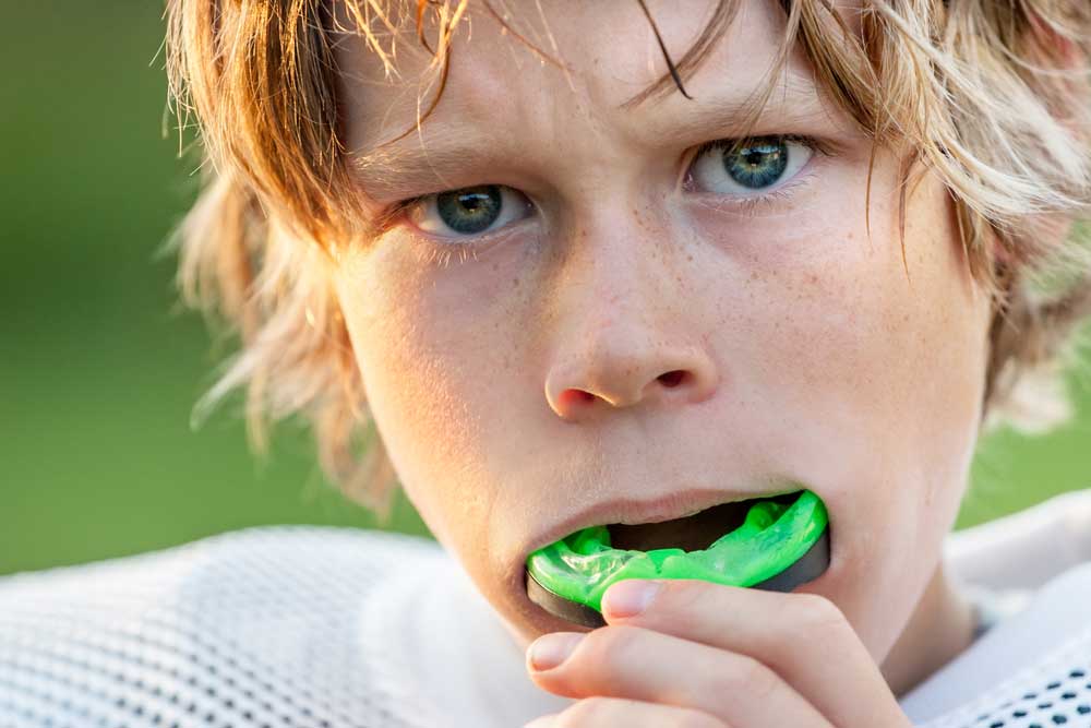 Mouth Guard